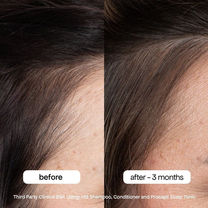 HAIR EXTENSION SYSTEM