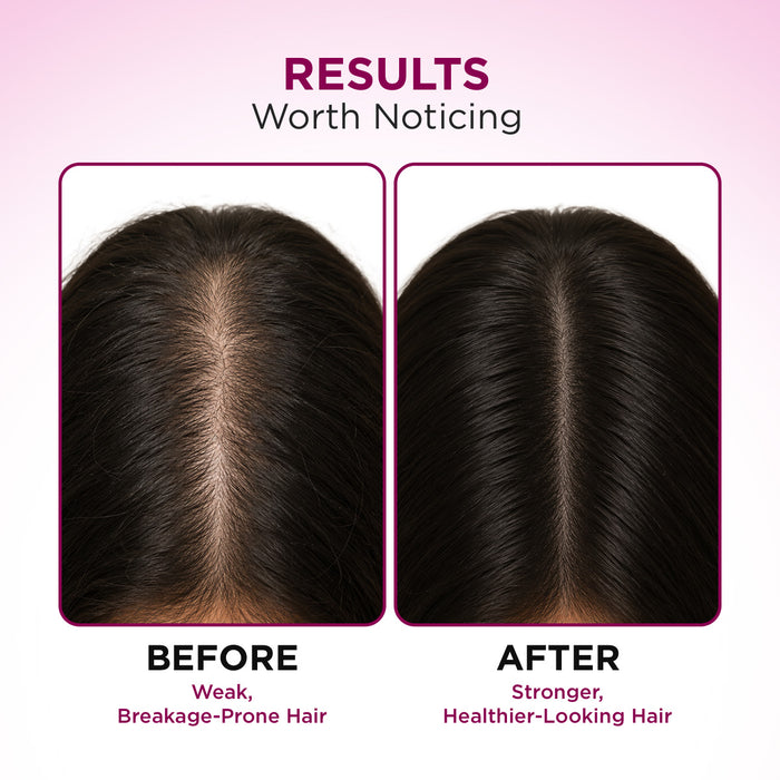 Deal Hair Fall Control Shampoo-650 ml