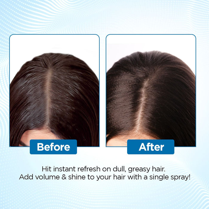 Deal Refresh Dry Shampoo to Instantly Refresh & Add Volume - 150 ml