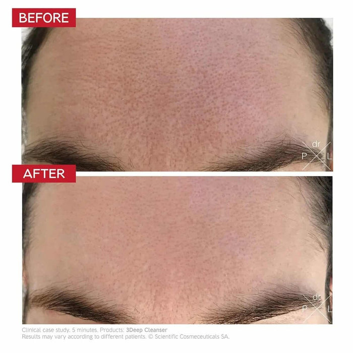 Dr. Levy 3 Deep Micro - resurfacing Cleanser 150ml - Beauty Tribe