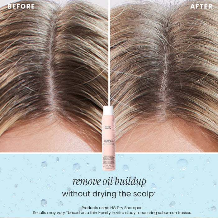 DRY SHAMPOO - 3 PACK