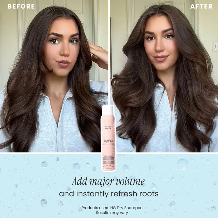 DRY SHAMPOO - 3 PACK